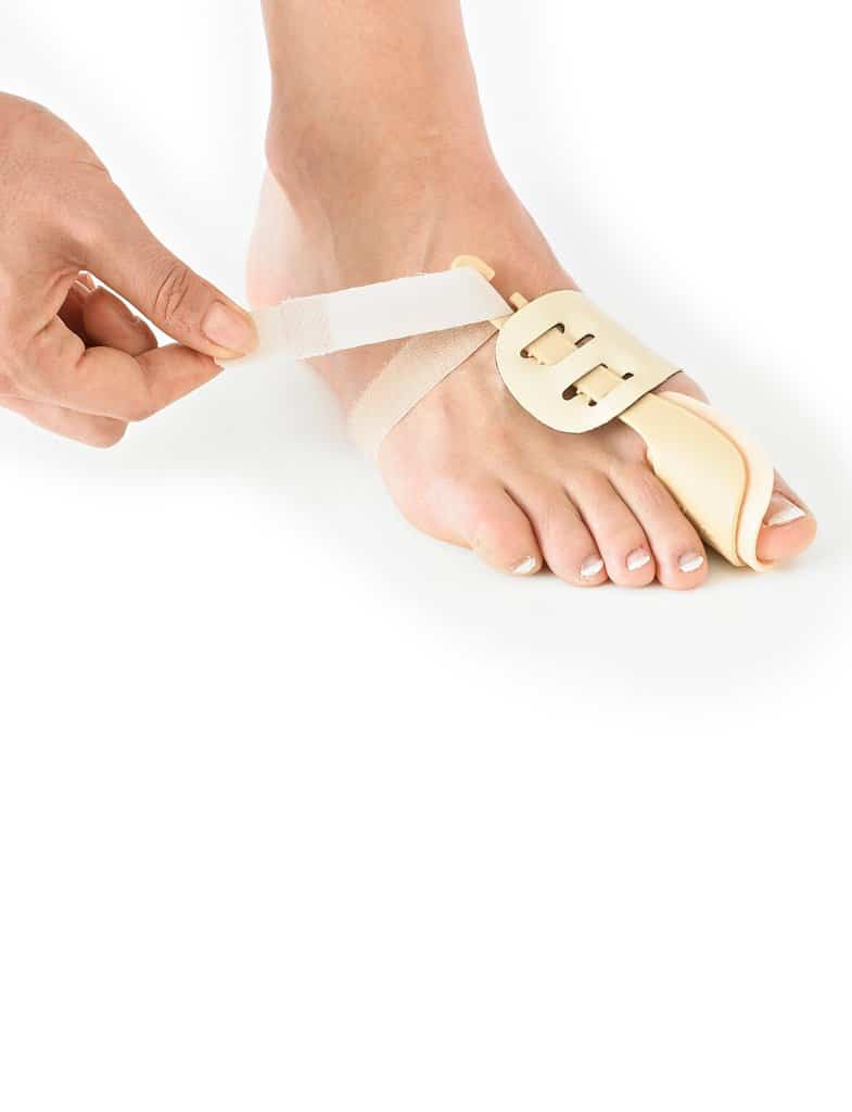 NEOG511 Bunion Correction system 4 | BlueShak Store